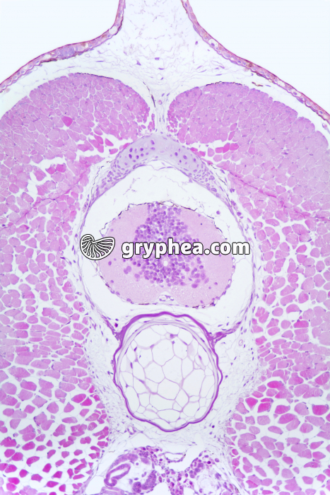 Tétard chorde et moelle épinière CT x25 - gryphea.org